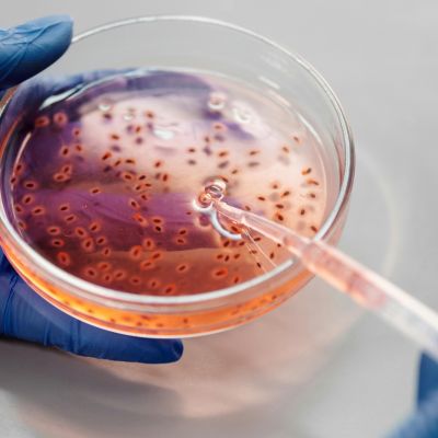 Photo of a teat pipette taking a sample from a petri dish